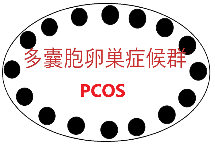 多嚢胞卵巣症候群PCOS