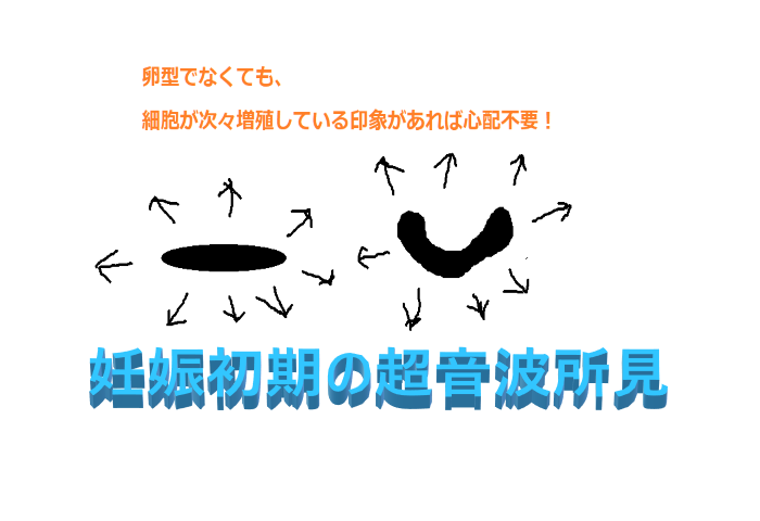 多嚢胞卵巣症候群pcos 多嚢胞卵巣症候群 Pcos 不妊治療 体質改善 原因 遺伝 やせ 肥満 インスリン抵抗性